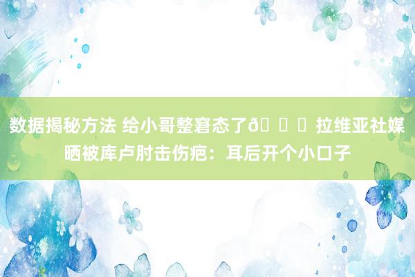 数据揭秘方法 给小哥整窘态了😅拉维亚社媒晒被库卢肘击伤疤：耳后开个小口子